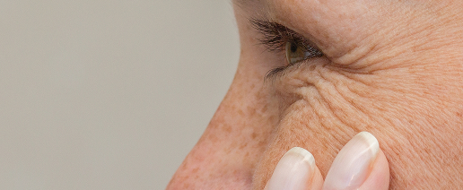 Tired or Aging Eyes