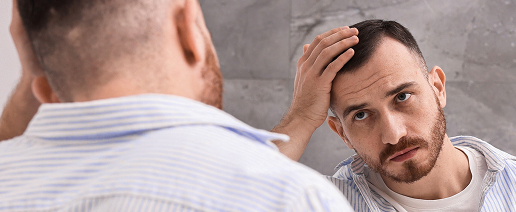 High hairline or hair thinning